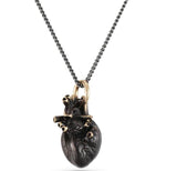 Black Anatomical Heart Necklace